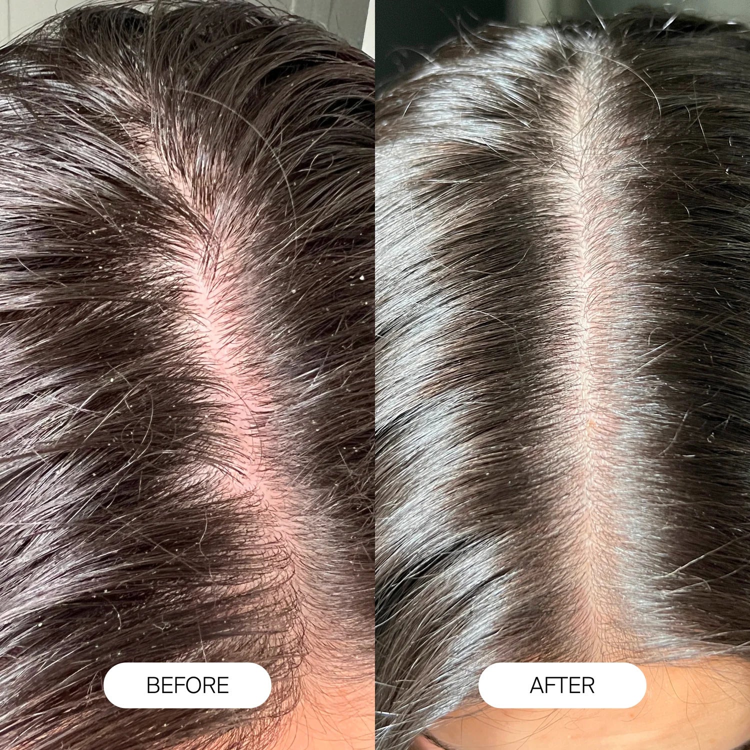 Showerpro Filtered Showerhead